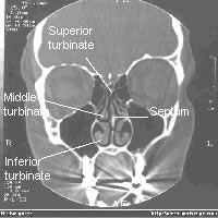 nose cross section